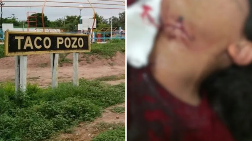Taco Pozo: Una mujer denunció que su expareja la atacó con un arma blanca